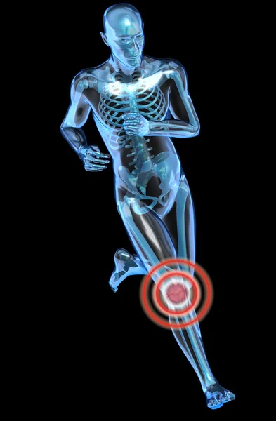 Running man seen by x-ray with pain in the leg — Stock Photo, Image