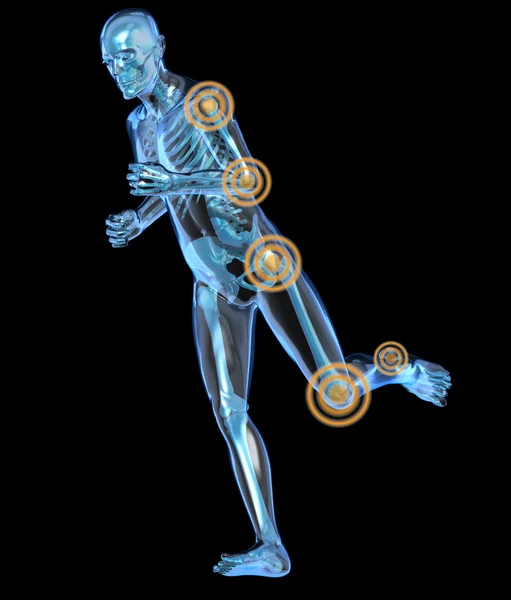 Side view of a running man seen by x-ray with pain in the leg and arm — Stock Photo, Image