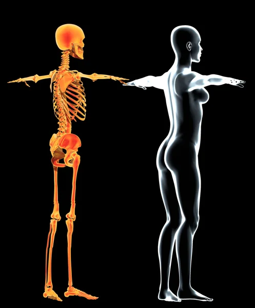Yan görünümü x-ray kadın, vücut ve iskelet — Stok fotoğraf