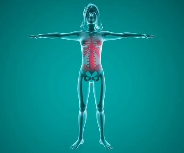 Human x-ray with pain in the spine and ribs — Stock Photo, Image