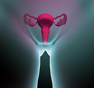 Human x-ray with pain in the uterus clipart