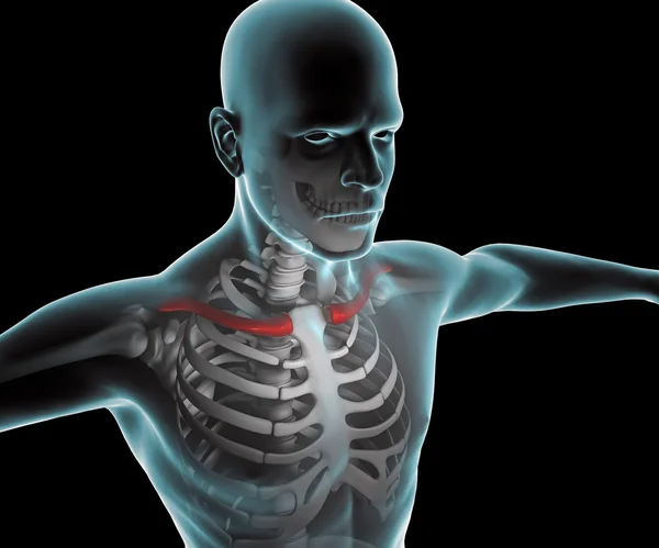 X ray van menselijk lichaam en skelet — Stockfoto