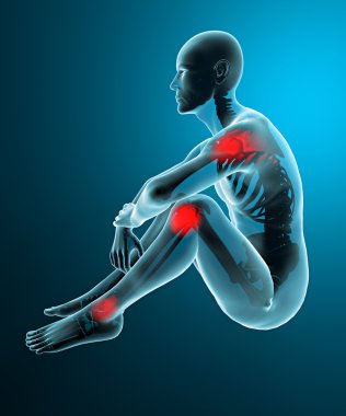 adam eklem ağrısı x-ray iskelet