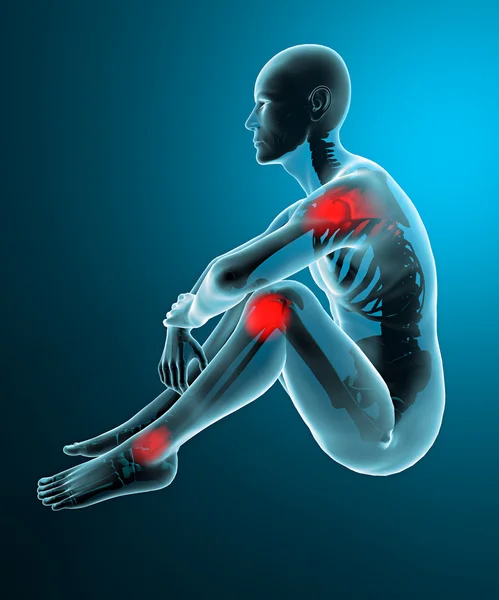 Szkielet x-ray stawów człowieka — Zdjęcie stockowe