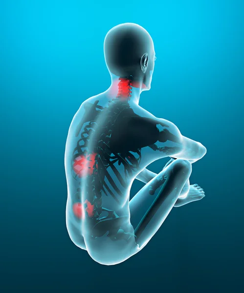 Man backache pain x-ray skeleton — Stock Photo, Image