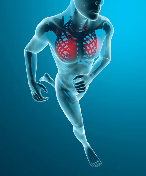 Human x-ray with pain in the ribs — Stock Photo, Image