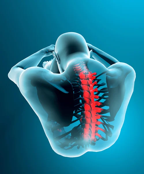 Pain in the neck and spine in a x-ray vision — Stock Photo, Image