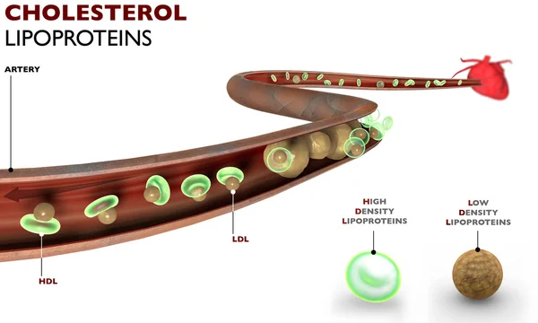 Cholesterol, vet vorming, slagader, hart — Stockfoto