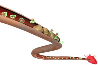 kolesterol, yağ oluşumu, damar, kalp