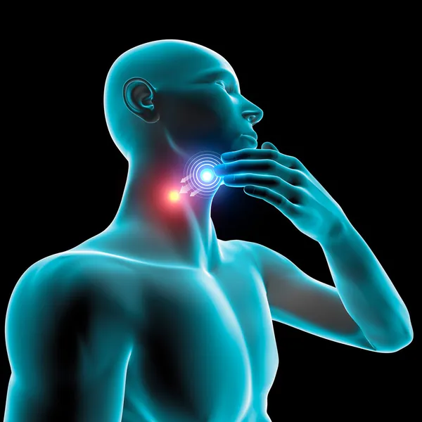Sore throat inflammation, pain, redness — Stock Photo, Image