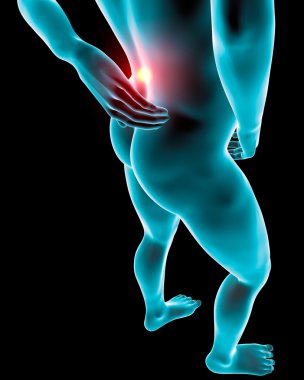 adam sırt ağrısı ağrı x-ray iskelet