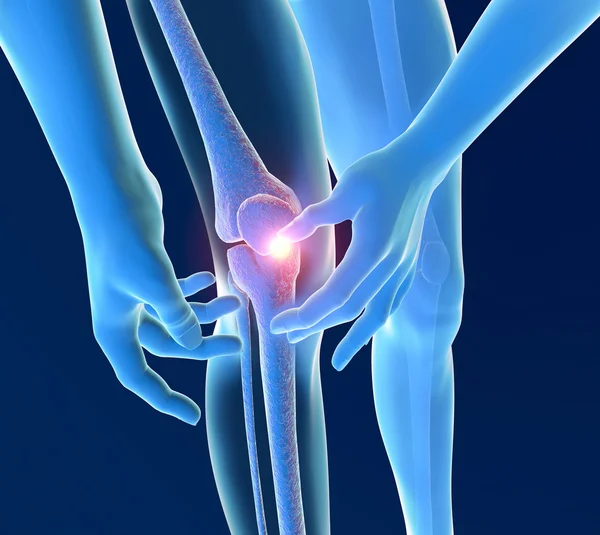 炎症の痛み膝 — ストック写真
