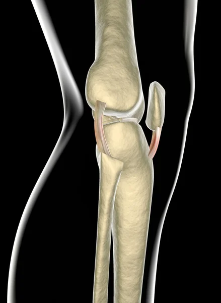 Ligamentos de rodilla, tendones, rayos X —  Fotos de Stock