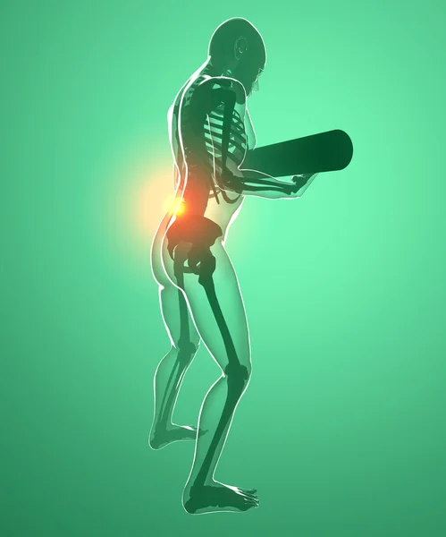 Back pain for a weightlifting — Stock Photo, Image