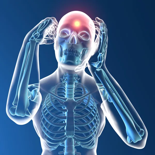 Humano de rayos X con dolor de cabeza — Foto de Stock