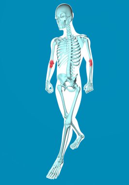 dirsek ağrısı ile yürüyen adam x-ray