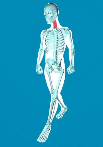 목에 통증으로 걷는 남자 x 선 — 스톡 사진