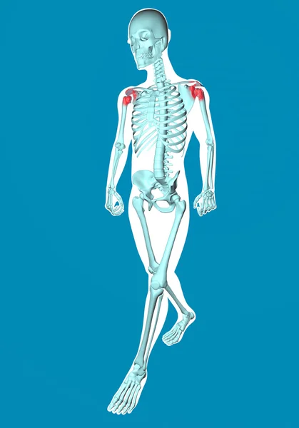 Gehender Mann mit Schmerzen in den Schultern geröntgt — Stockfoto