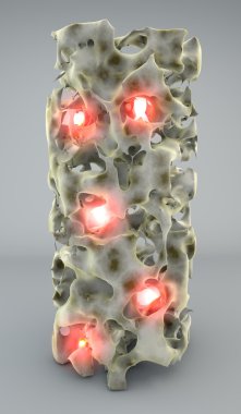 Section of bone with osteoporosis clipart