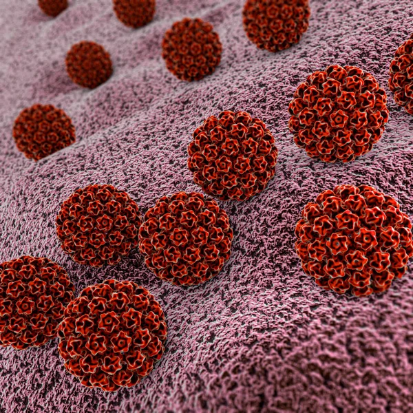 Humane Papillomavirus Infektion Virus Hpv Ist Die Weltweit Häufigste Sexuell — Stockfoto