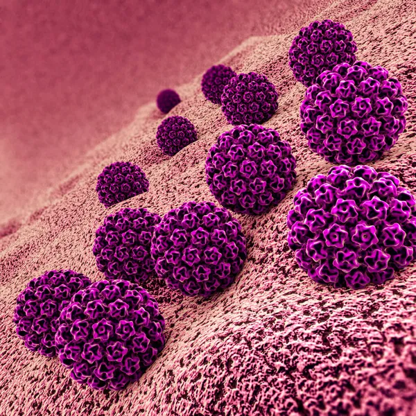 ひと乳頭腫ウイルスの感染症です ウイルス Hpv 最も一般的な性感染症世界です Hpv 感染は ヒトパピ ローマ ウイルス ヒトパピ — ストック写真