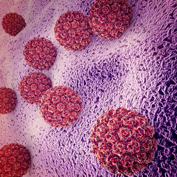 Infezione Papillomavirus Umano Virus Hpv Infezione Sessualmente Trasmessa Più Comune — Foto Stock