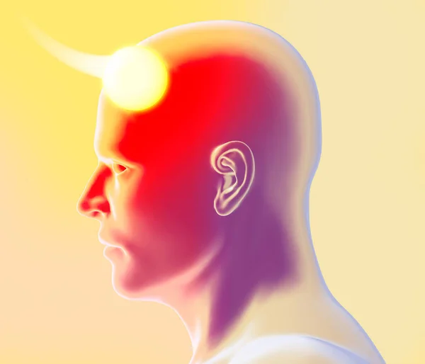 Ansiktet Man Sedd Från Sidan Huvudvärk Och Bihåleinflammation Piller För — Stockfoto