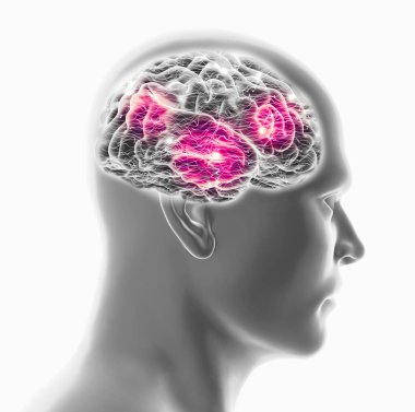 İnsan beyni ve insan yüzü, yan görüş. Röntgenler. Dejeneratif hastalıklar, sinapslar ve nöronlar, beyin fonksiyonları. Felç ve bilişsel sorunlar. Parkinson ve Alzheimer. 3d oluşturma