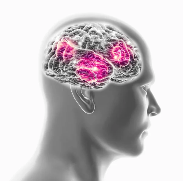 Cérebro Humano Rosto Humano Vista Lateral Raios Doença Degenerativa Sinapses — Fotografia de Stock