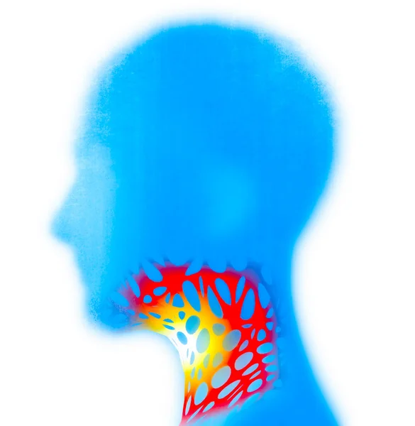 喉咙疼痛的人的侧视 燃烧和肿胀 3D渲染 — 图库照片