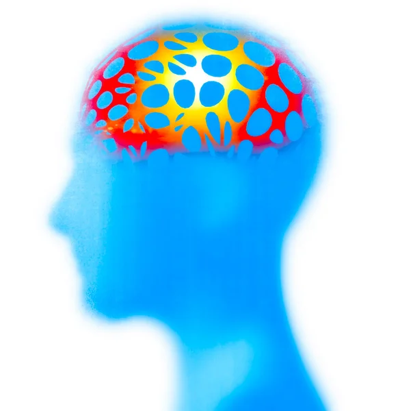 Side View Man Headache Brain Pain Symptoms Vertigo Drop Blood — Stock Photo, Image