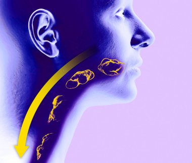 Yutkunma bozukluğu, disfaji. Farenjit ve özofajiyal disfaji. Oral evre. Yemek yolu, yutma eylemi. Kafa röntgeni, ağızdan mideye kadar. 3d oluşturma