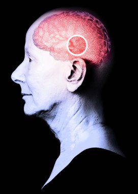 Beynin nasıl çalıştığını. Sinapslar ve nöronlar. Bağlantılar. Beyninle, uyarıcılarınla ve fikirlerinle ilgilen. Dejeneratif hastalıklar, Parkinson ve Alzheimer. Yaşlı kadın bakış açısı. 3d oluşturma