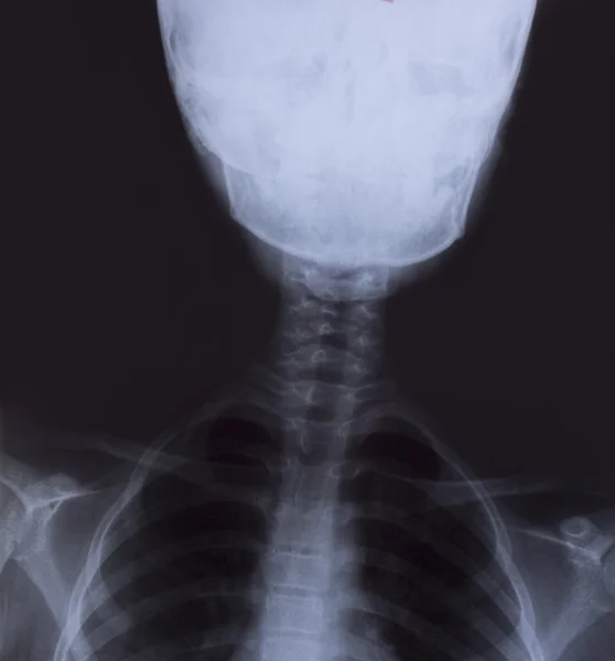 Detail of neck and head x-ray image — Stock Photo, Image
