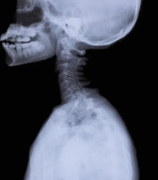 A nyak és a fej röntgen kép részlet Stock Kép