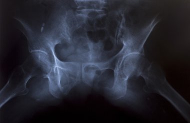 tıbbi tanı için insan göğüs x-ray görüntüsü
