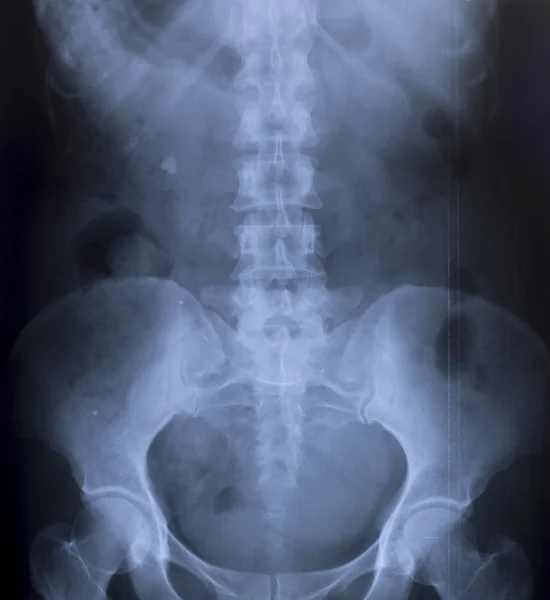 Imagen de Rayos X del Pecho Humano para un diagnóstico médico —  Fotos de Stock