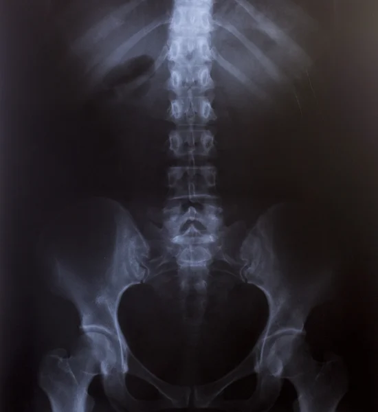 Image radiographique du thorax humain pour un diagnostic médical — Photo