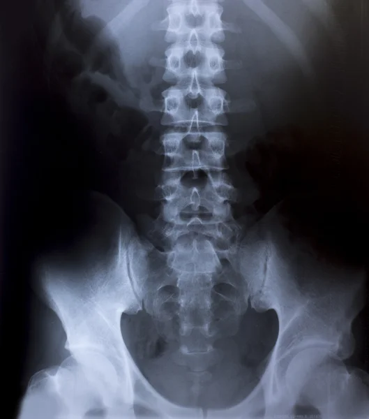 Image radiographique du thorax humain pour un diagnostic médical — Photo