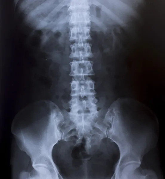 人类胸部医用诊断 x 射线图像 — 图库照片