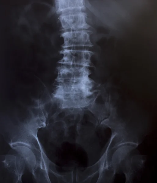 Image radiographique du thorax humain pour un diagnostic médical — Photo