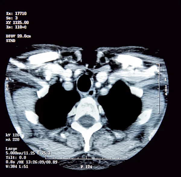 X-ray — стоковое фото