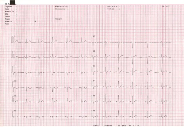 Echo cardiogram. — Stock Photo, Image