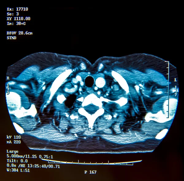 X ray contrast Stock Photos, Royalty Free X ray contrast Images