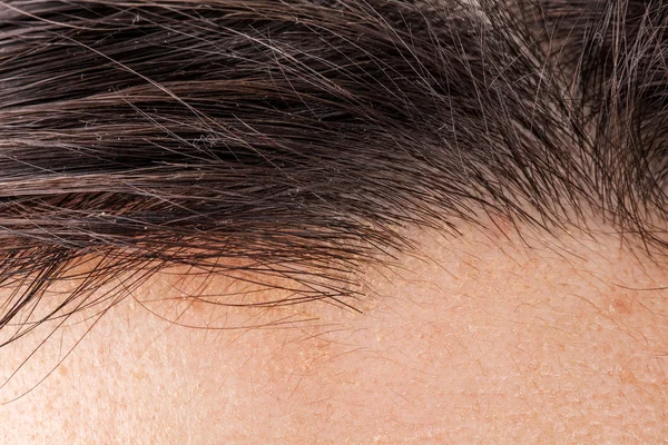 Hair of head — Stock Photo, Image