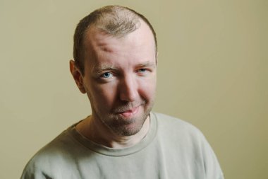 Adam şüpheli görünüyor. Surat yapan genç bir adamın portresi.