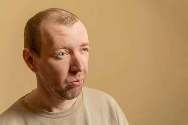 Male portrait, close-up. A balding middle-aged European looks narrowly.