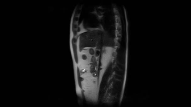 CT sken břicha. Počítačová tomografie gastrointestinálního traktu, jater a ledvin. — Stock video