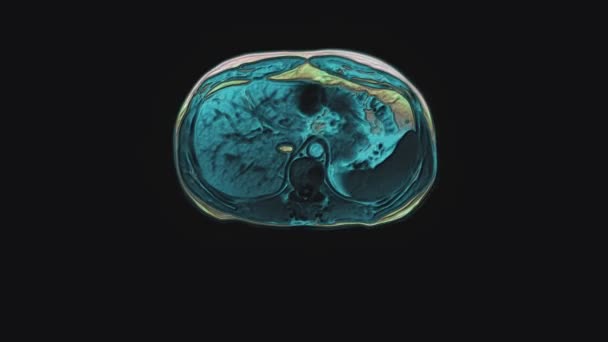 Karın bölgesinde çok renkli tomografi taraması. Mide, karaciğer ve böbreklerin tomografisi. — Stok video