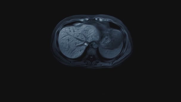 Objemný barevný CT sken břicha. Počítačová tomografie gastrointestinálního traktu, jater a ledvin — Stock video